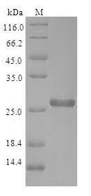 Human PNMA1 / MA1 Protein (Recombinant 10His-B2M-JD, N-terminus + Myc, C-terminus)