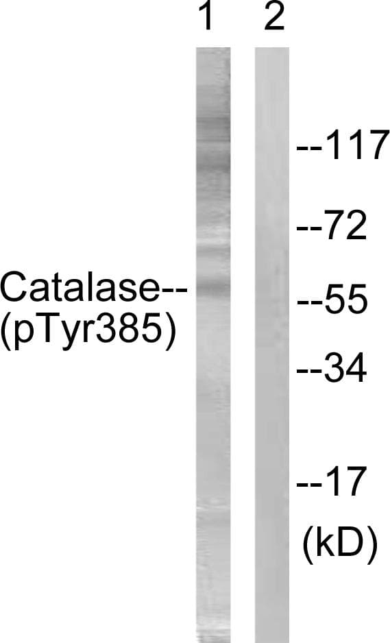 Polyclonal Rabbit anti-Human CAT / Catalase Antibody (phospho-Tyr385, IHC, WB)
