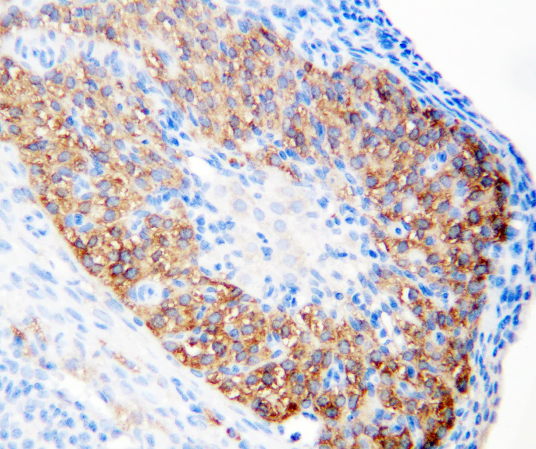 LHCGR / LHR / LH Receptor Antibody (aa127-143)