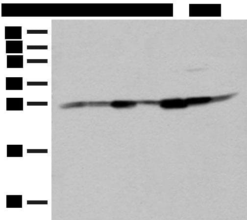 GBAS Antibody