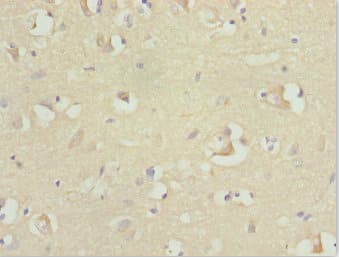 Polyclonal Rabbit anti-Human RFPL2 Antibody (IHC, WB)