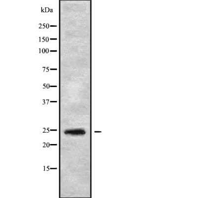 Polyclonal Rabbit anti-Human SOST / Sclerostin Antibody (IF, WB)