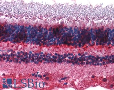 PathPlus™ Polyclonal Rabbit anti-Human GRM7 / MGLUR7 Antibody (N-Terminus, IHC, WB)