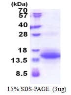Human UQCRH Protein (Recombinant His)