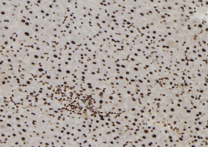 Polyclonal Rabbit anti-Human MTA3 Antibody (IHC, IF, WB)
