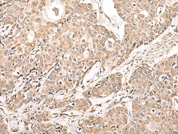 Polyclonal Rabbit anti-Human NDUFB11 Antibody (IHC, WB)