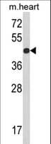 Polyclonal Rabbit anti-Human RGP1 Antibody (aa243-271, IHC, WB)