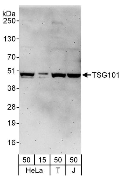 IHC-plus™ Polyclonal Rabbit anti-Human TSG101 Antibody (aa225-275, IHC, WB)