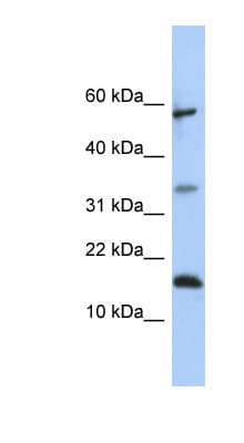 LCN6 Antibody (C-Terminus)