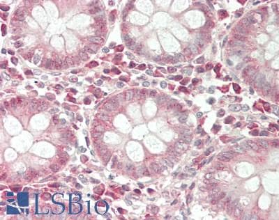 IHC-plus™ Polyclonal Rabbit anti-Human PTGFRN Antibody (aa815-879, IHC, WB)