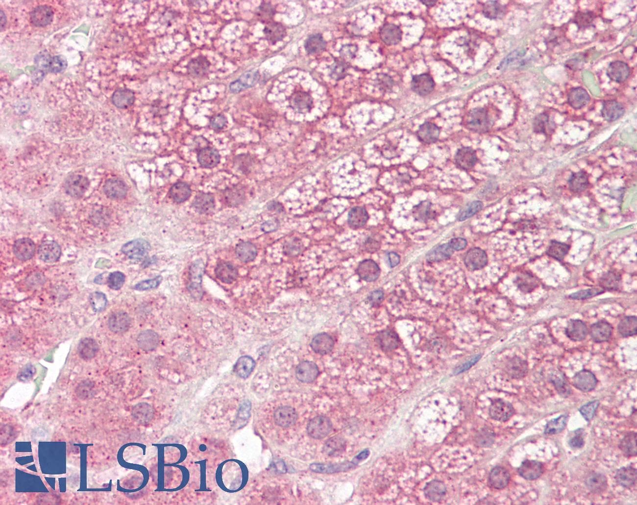 IHC-plus™ Polyclonal Rabbit anti-Human DIAPH3 / MDIA2 Antibody (IHC, WB)