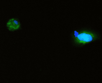 SQSTM1 Antibody