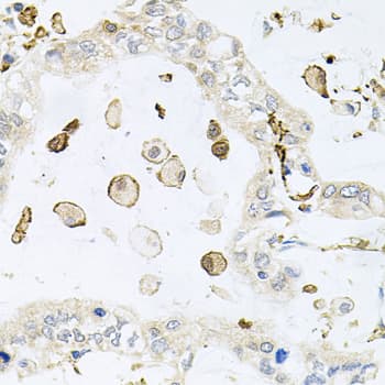 Polyclonal Rabbit anti-Human AIF1 / IBA1 Antibody (IHC, IF, WB)