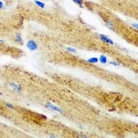 GLRX3 / Glutaredoxin 3 Antibody