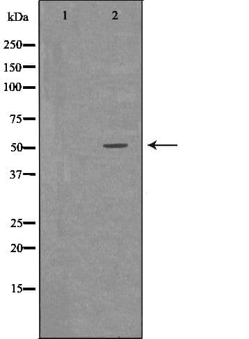 Polyclonal Rabbit anti-Human CTSA / Cathepsin A Antibody (IHC, WB)