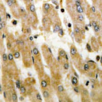 DUSP1 + DUSP4 Antibody (C-Terminus)