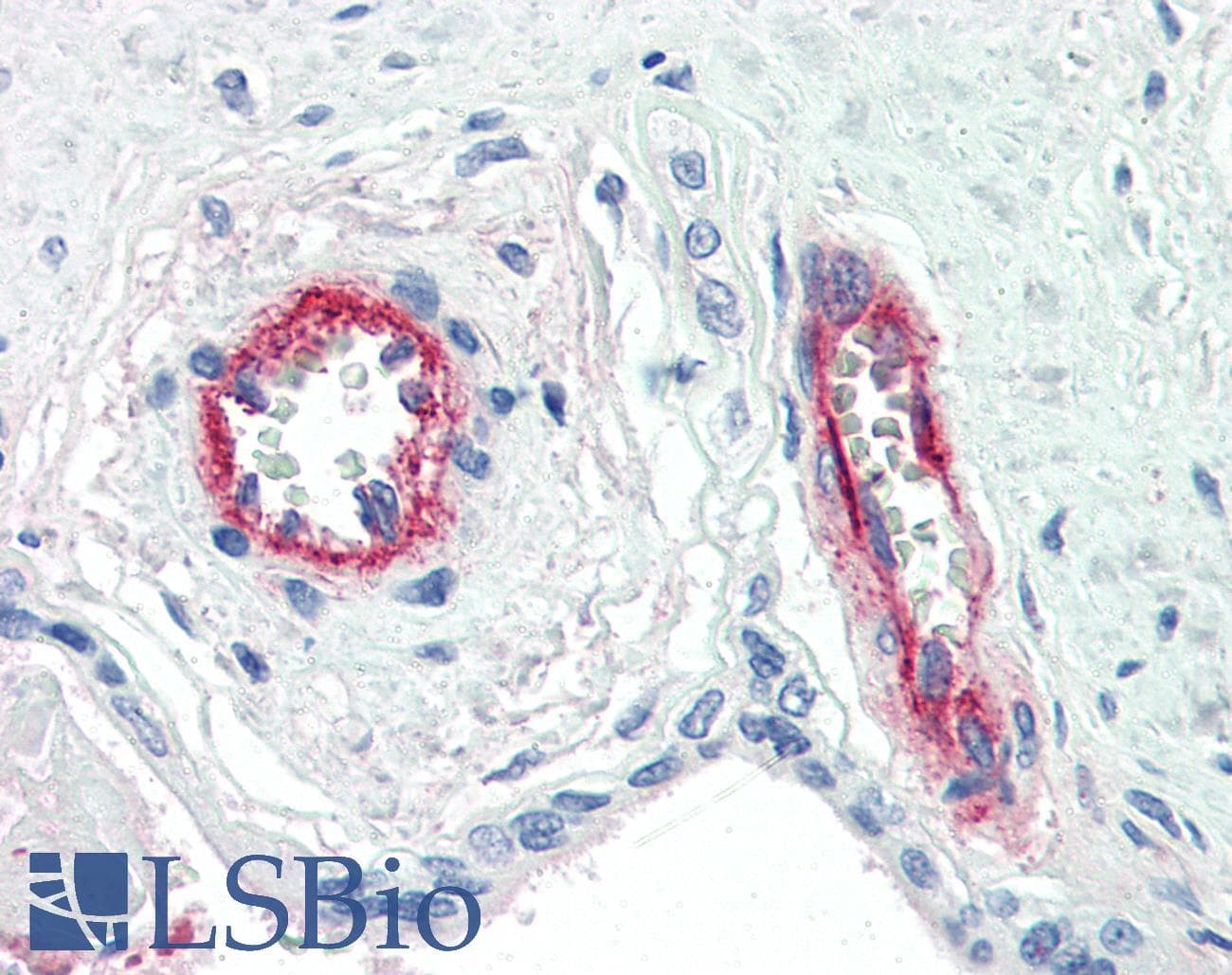 PathPlus™ Monoclonal Mouse anti-Human F8 / FVIII / Factor VIII Antibody (clone F8 2.2.9, IHC, WB)