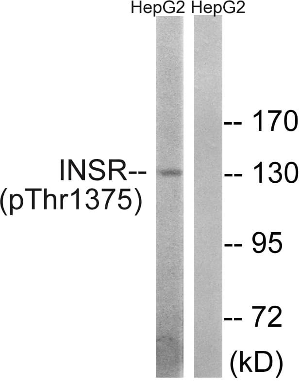 INSR / Insulin Receptor Antibody (phospho-Thr1375)
