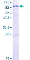 Human RGS12 Protein (Recombinant GST)