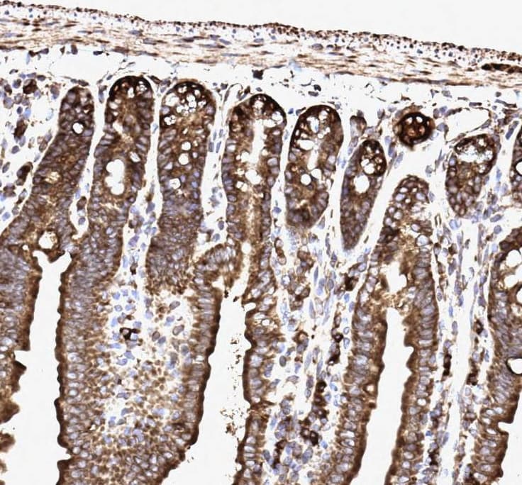 Polyclonal Rabbit anti-Human SSR3 / TRAP-Gamma Antibody (aa8-23, IHC, WB)
