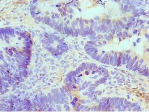 ATRIP Antibody (aa1-260)
