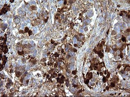 SERPINB3 Antibody (clone OTI1G9)