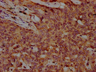 FBXO10 Antibody