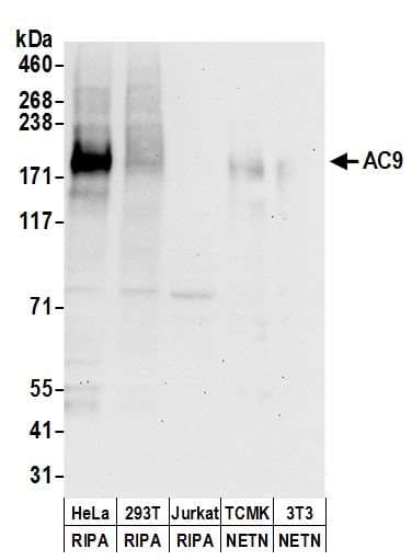 ADCY9 / Adenylate Cyclase 9 Antibody (aa1303-1353)