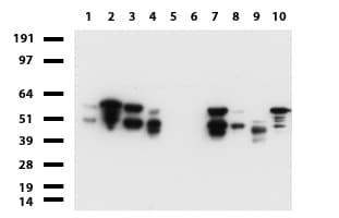 Vimentin Antibody (clone UMAB160, Carrier-free)