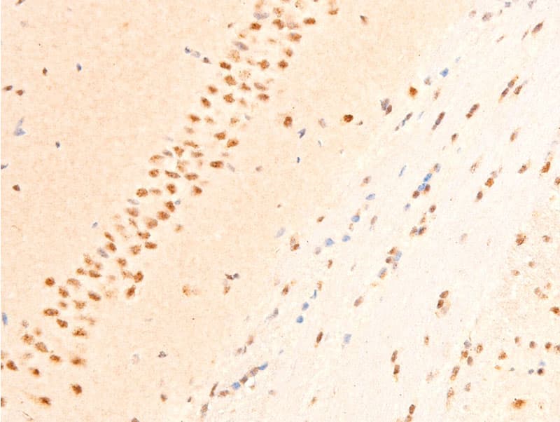 JUN / c-Jun Antibody (phospho-Thr239)