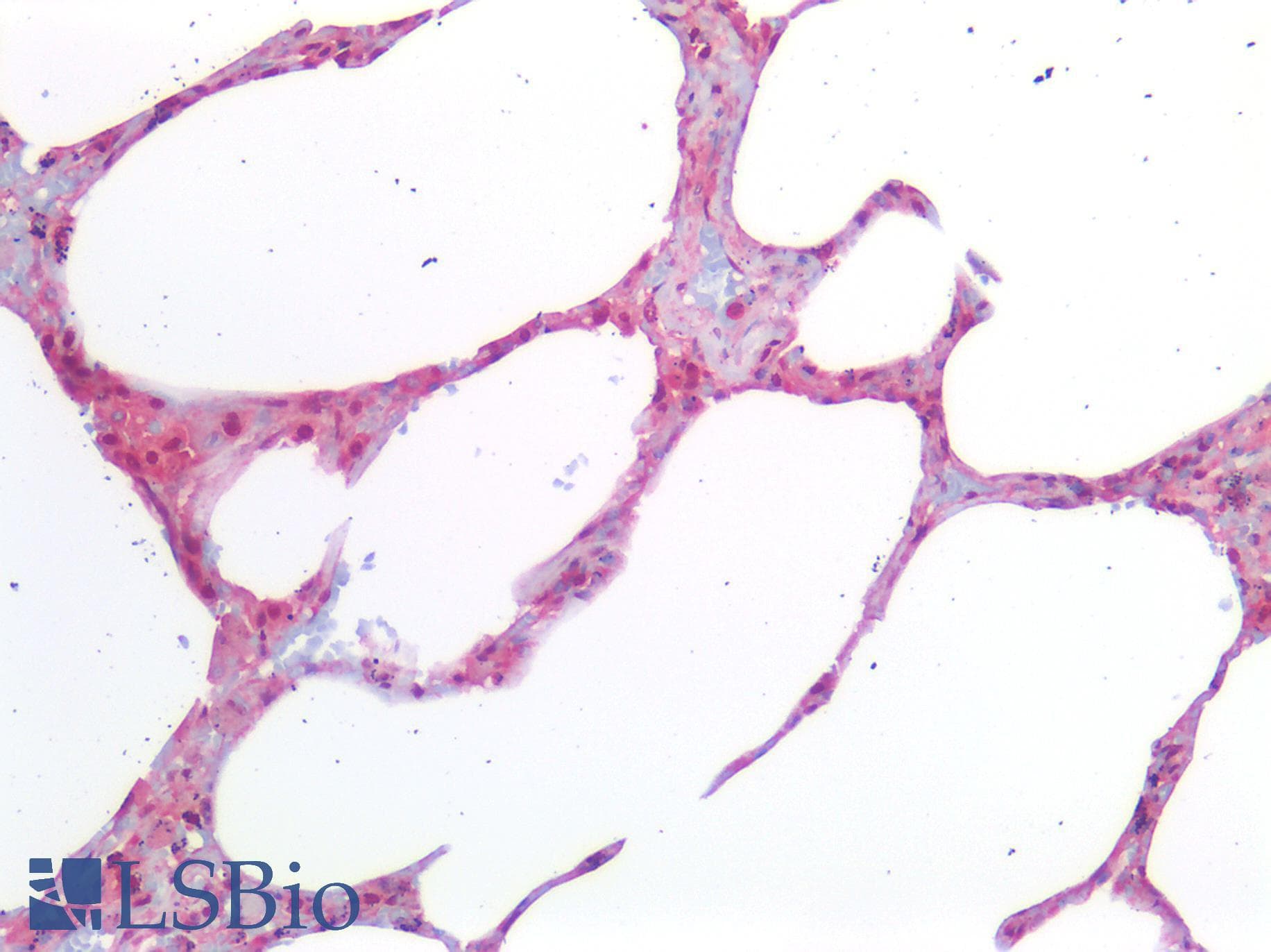 IHC-plus™ Polyclonal Rabbit anti-Human IL23A / IL-23 p19 Antibody (IHC)