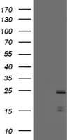 Monoclonal Mouse anti-Human PYCARD / ASC / TMS1 Antibody (clone OTI3E9, IHC, WB)