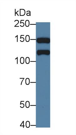 KTN1 / Kinectin Antibody (aa1104-1357)