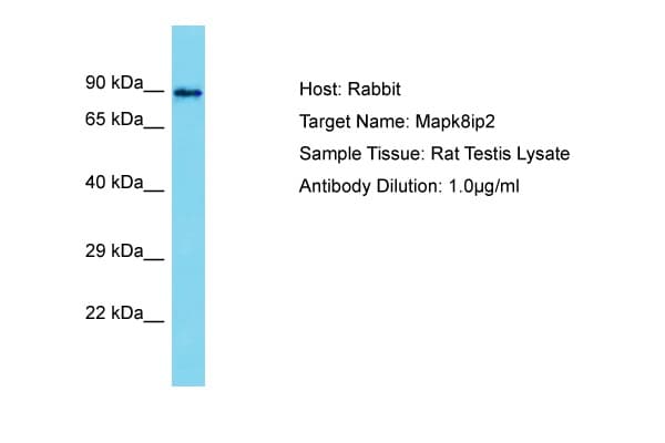 MAPK8IP2 / JIP2 Antibody (aa307-356)
