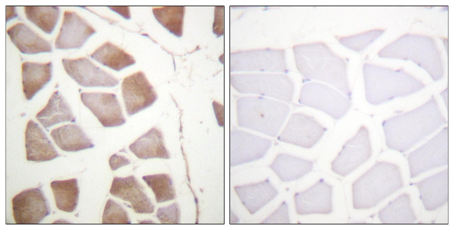 Polyclonal Rabbit anti-Human DAPK2 / DAP Kinase 2 Antibody (Ab-318, IHC)