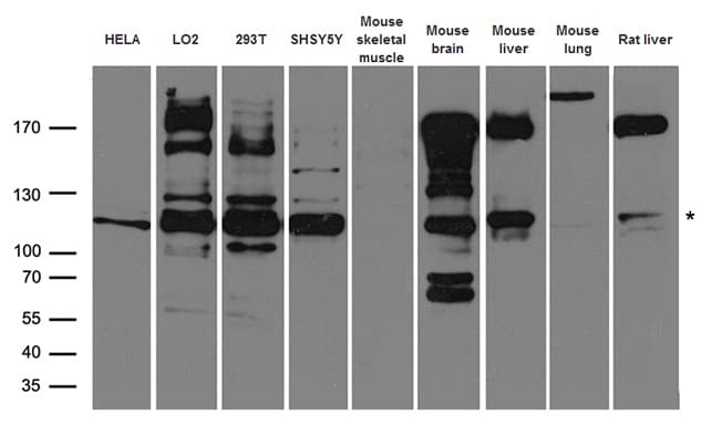 IRS2 / IRS-2 Antibody