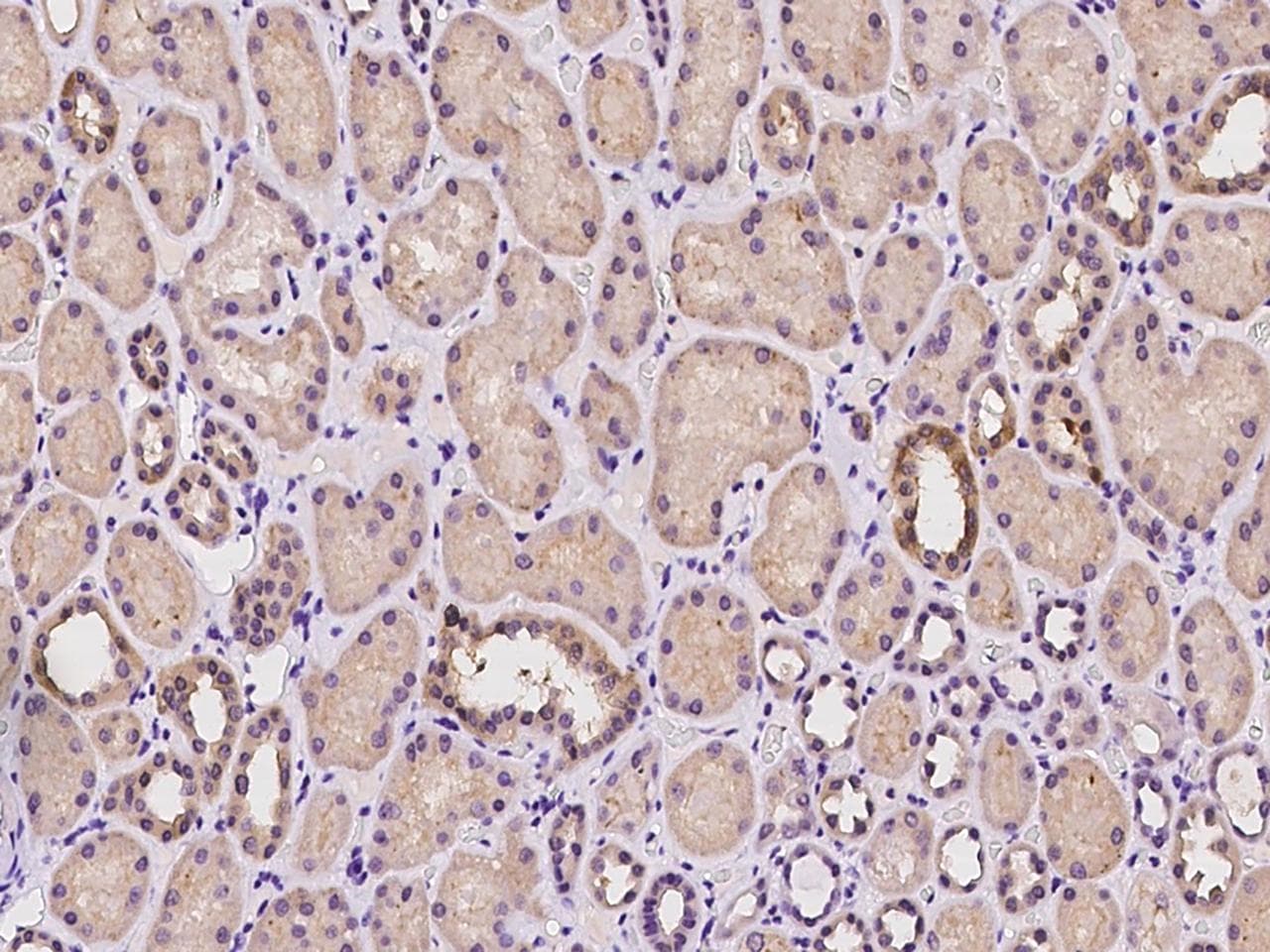 SUCLG2 Antibody