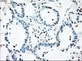 BRAF / B-Raf Antibody (clone OTI3B12)