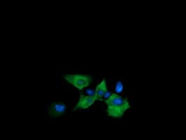 CTAG1B / NY-ESO-1 Antibody (clone OTI5B9)