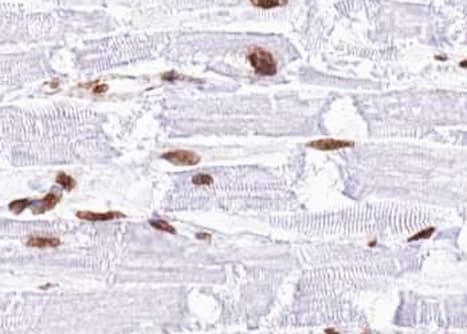 MAP2K4 / MKK4 Antibody (phospho-Thr261)