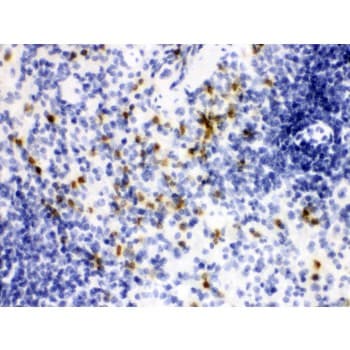 Polyclonal Rabbit anti-Rat LCN2 / Lipocalin 2 / NGAL Antibody (aa21-198, IHC, WB)