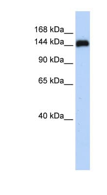 GSE1 / KIAA0182 Antibody (aa72-121)