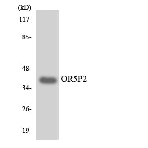 Polyclonal Rabbit anti-Human OR5P2 Antibody (aa183-232, WB)