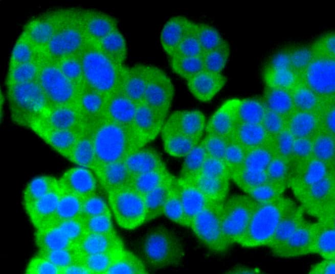 PRKCA / PKC-Alpha Antibody