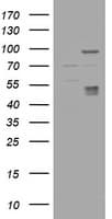 CA12 / Carbonic Anhydrase XII Antibody (clone OTI3F1)