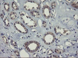 Monoclonal Mouse anti-Human COMMD1 Antibody (clone OTI1C3, IHC, WB)
