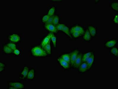 IHC-plus™ AGT / Angiotensinogen Antibody (aa35-285)