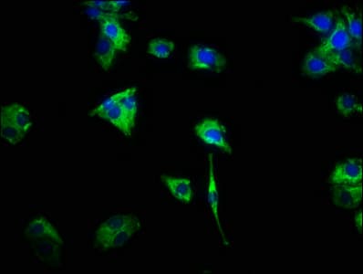 CSF2RA / CD116 Antibody (aa23-320)