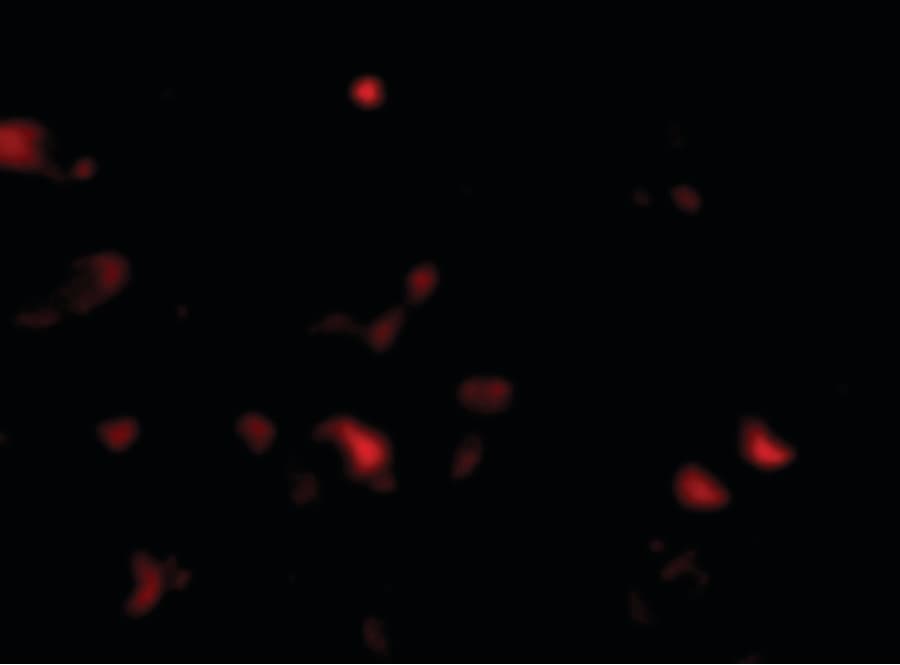 IHC-plus™ Polyclonal Rabbit anti-Human JPH3 Antibody (IHC, IF, WB)