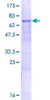 Human SLC25A23 Protein (Recombinant GST)
